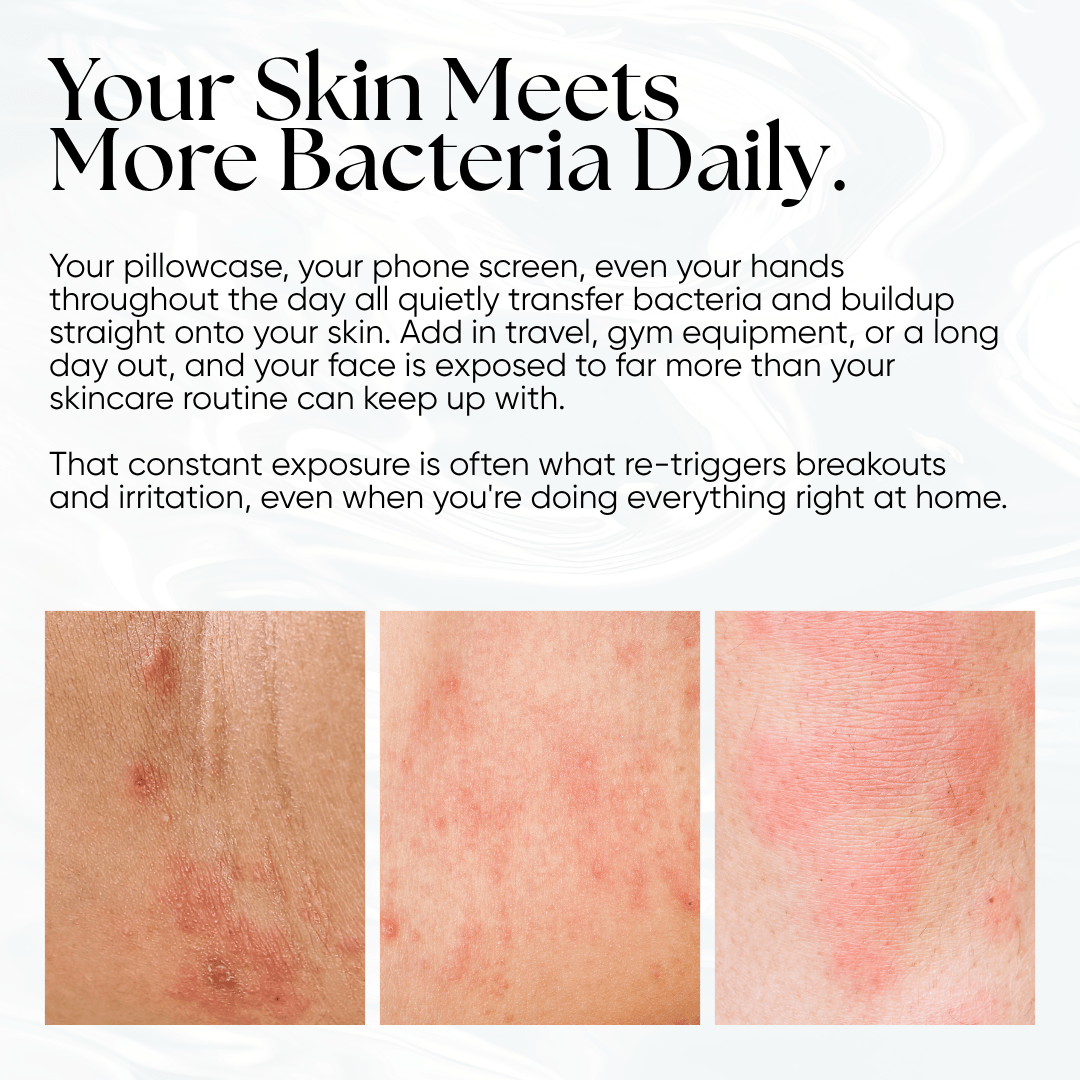 Skin Reset Hypochlorous Spray - CHEEKYGLO