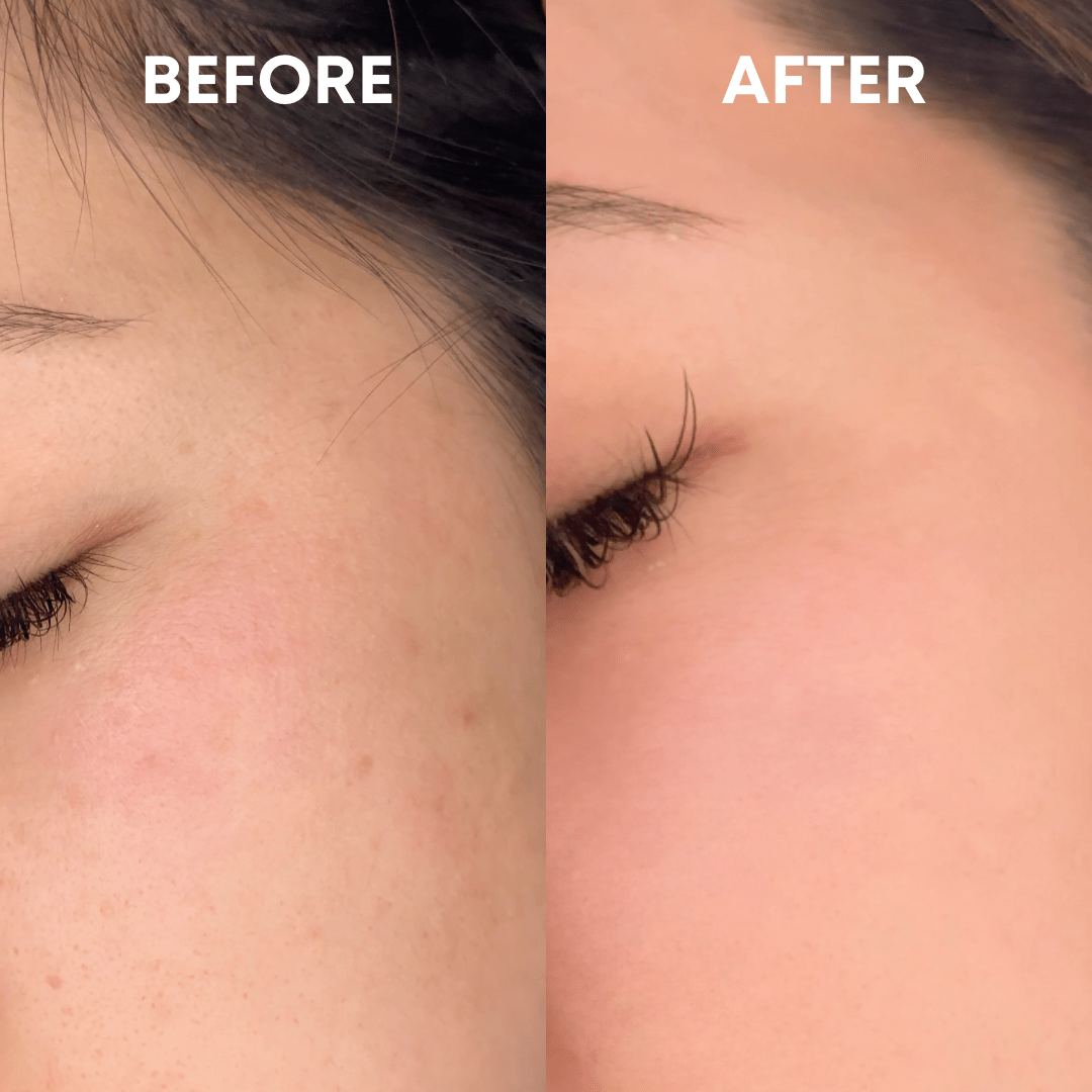 Skin Reset Hypochlorous Spray - CHEEKYGLO