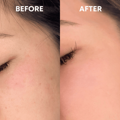 Skin Reset Hypochlorous Spray - CHEEKYGLO