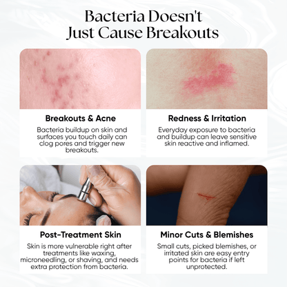 Skin Reset Hypochlorous Spray - CHEEKYGLO