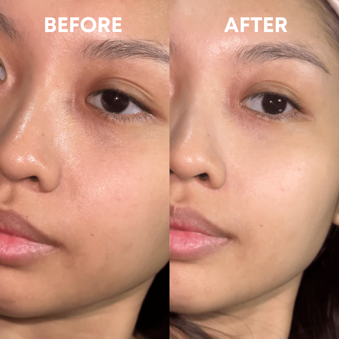 Skin Reset Hypochlorous Spray - CHEEKYGLO