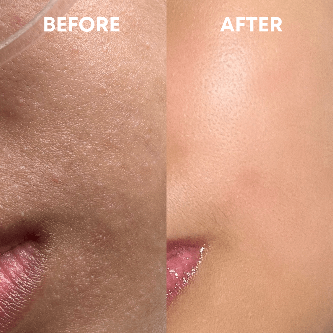 Skin Reset Hypochlorous Spray - CHEEKYGLO