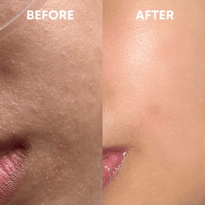 Skin Reset Hypochlorous Spray - CHEEKYGLO