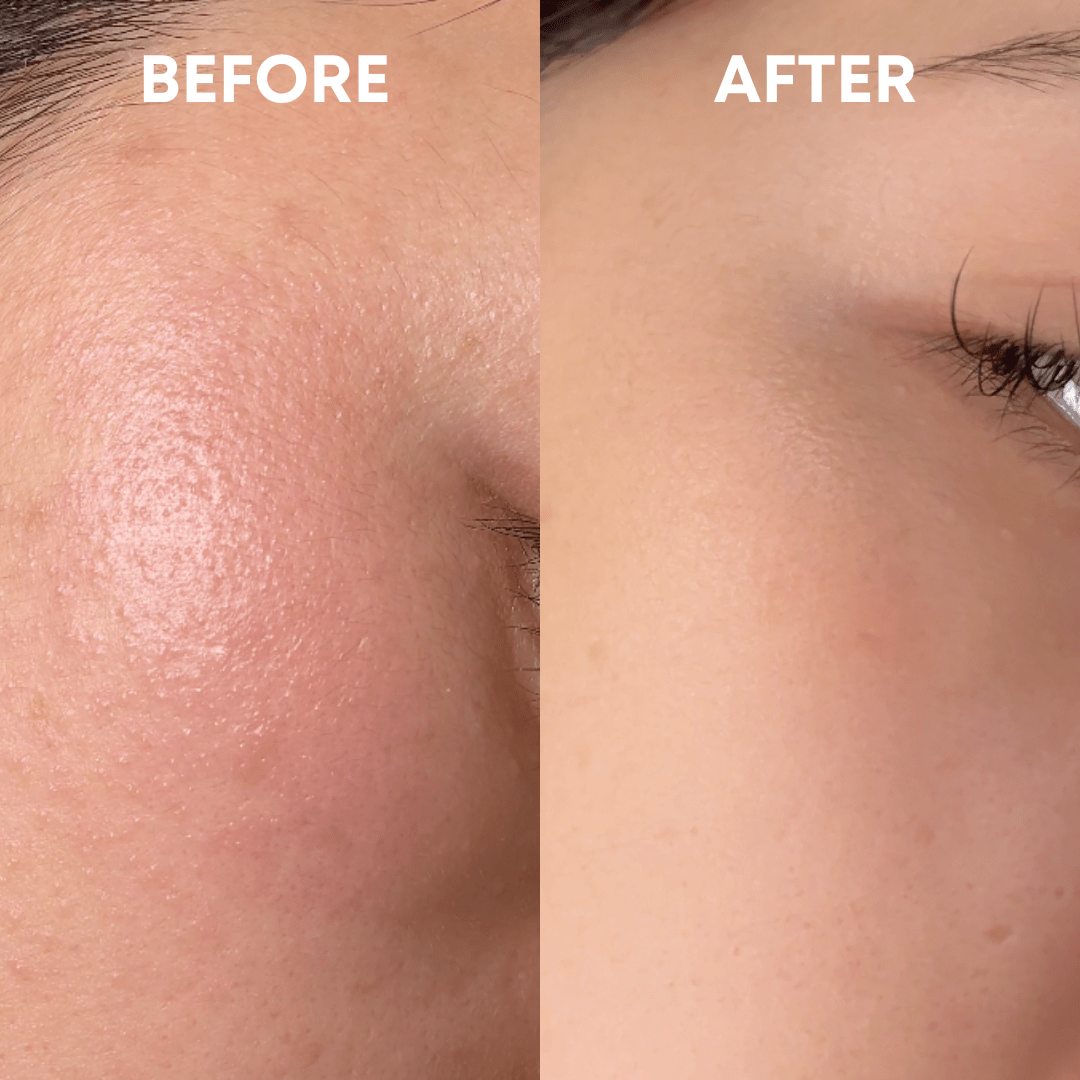 Skin Reset Hypochlorous Spray - CHEEKYGLO