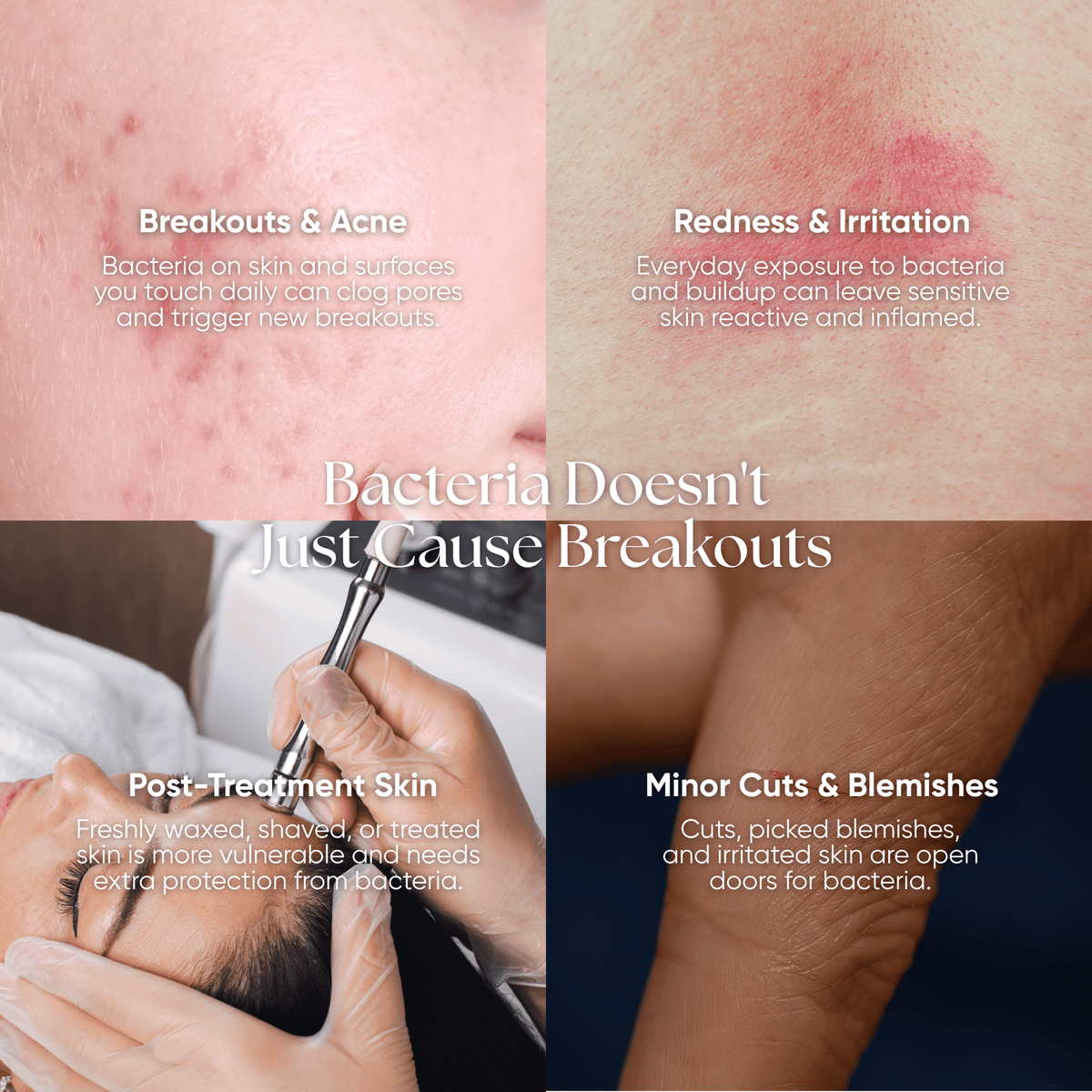 Skin Reset Hypochlorous Spray - CHEEKYGLO