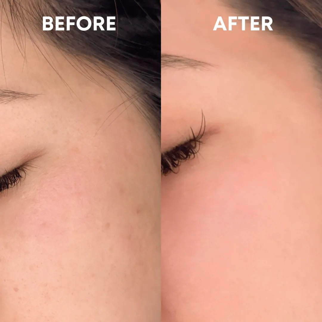 Skin Reset Hypochlorous Spray - CHEEKYGLO