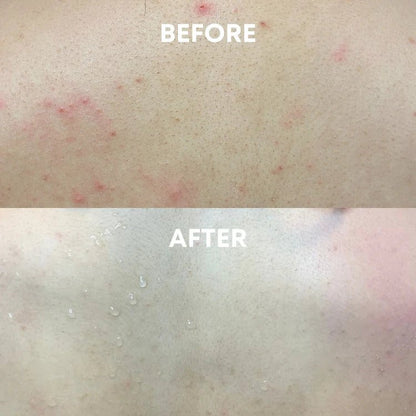 Ultimate Glow Set + Free Makeup Bag - CHEEKYGLO