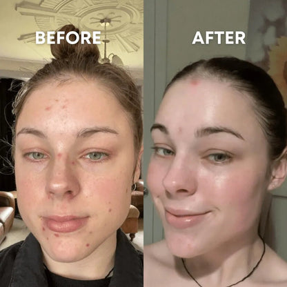 Ultimate Glow Set + Free Makeup Bag - CHEEKYGLO