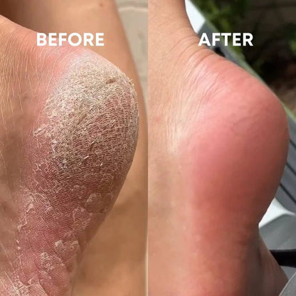 What A Steal Kit (Boxing Day Limited Edition) - CHEEKYGLO