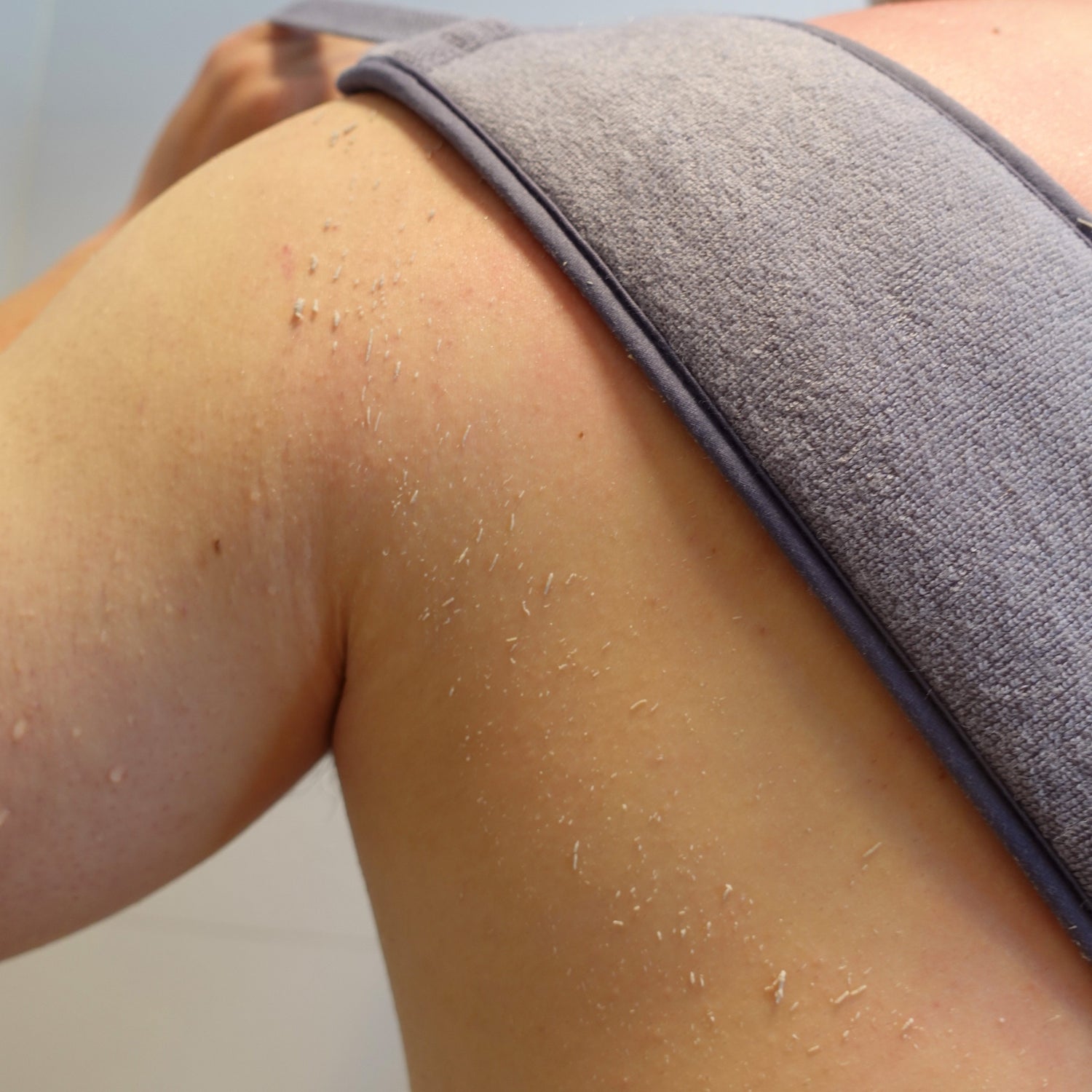 Close-up of a person using a gray towel to dry their shoulder, revealing congested, flaky skin. Tension on the towel shows as it&