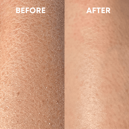 Side-by-side comparison of skin showing results before and after treatment with the CheekyGlo Exfoliating Glove. The left side labeled &quot;BEFORE&quot; displays dry, flaky skin, while the right side labeled &quot;AFTER&quot; showcases smoother, hydrated skin treated by CheekyGlo.