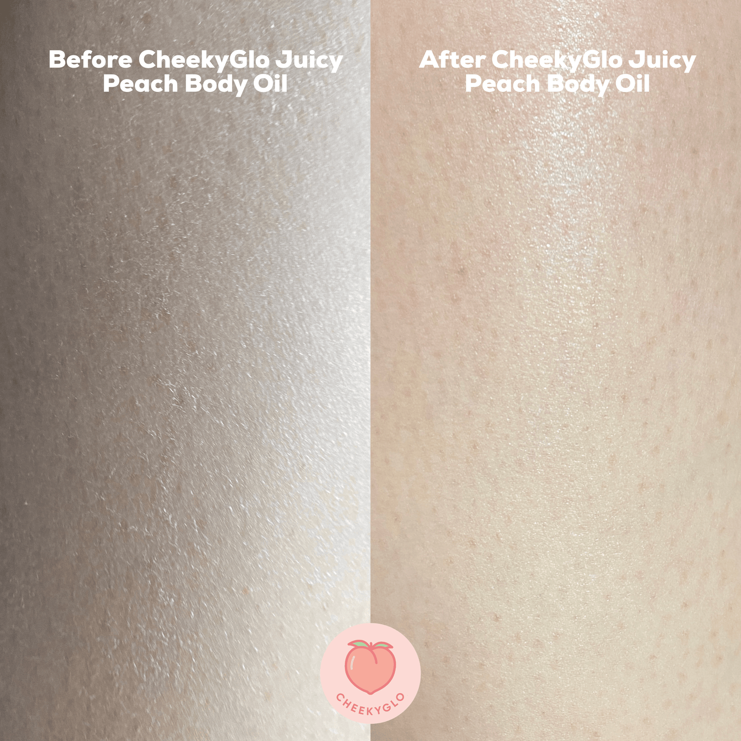 Side-by-side close-up images of skin. The left side displays dull, dry skin before using CheekyGlo Juicy Peach Body Oil, while the right side reveals hydrated, glowing skin after application. The CheekyGlo logo is centered at the bottom. Text at the top emphasizes the dramatic before and after transformation.