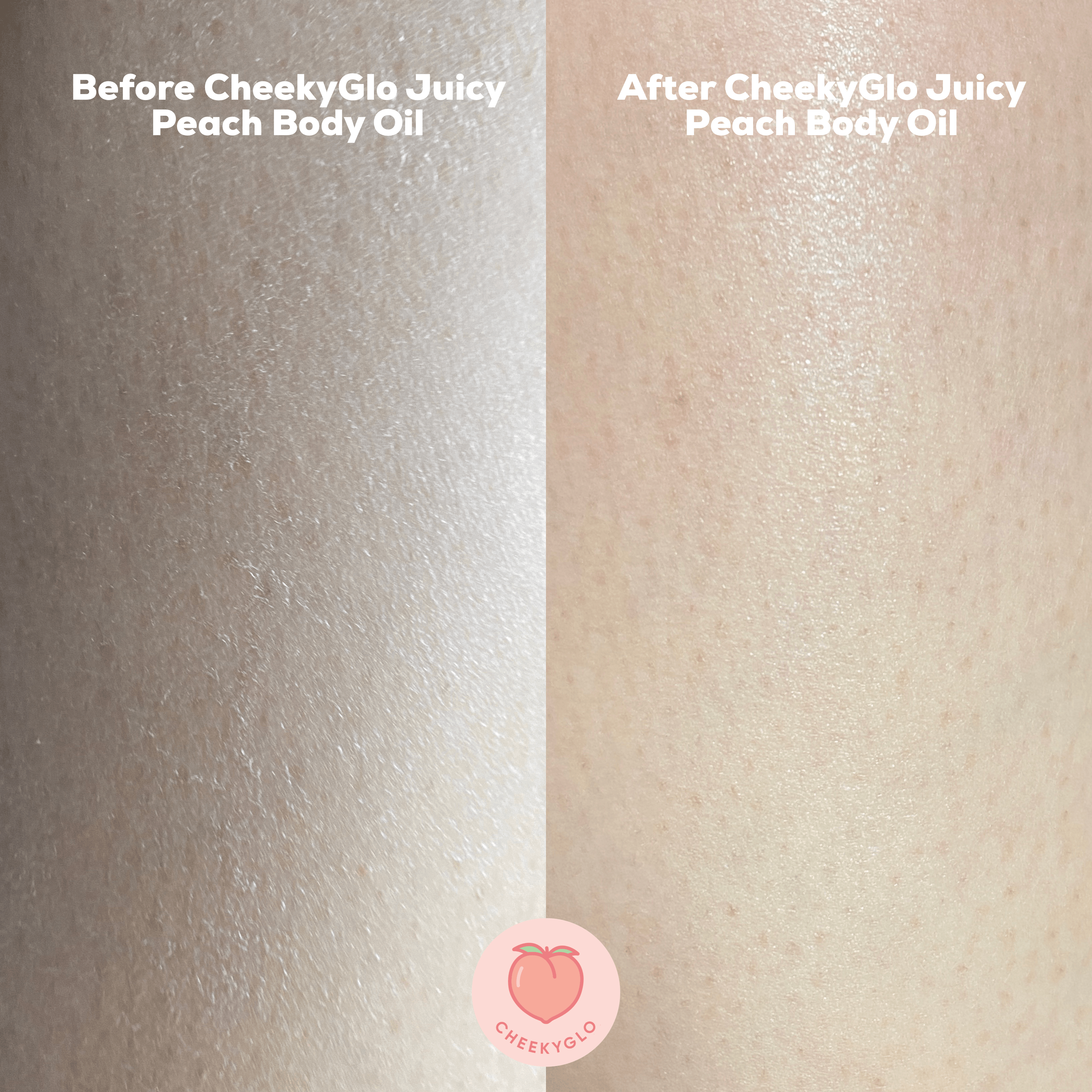 Side-by-side close-up images of skin. The left side displays dull, dry skin before using CheekyGlo Juicy Peach Body Oil, while the right side reveals hydrated, glowing skin after application. The CheekyGlo logo is centered at the bottom. Text at the top emphasizes the dramatic before and after transformation.